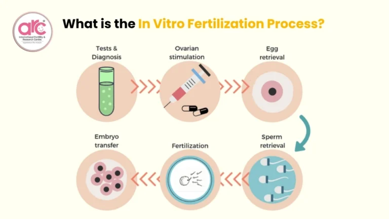 In Vitro Fertilization
