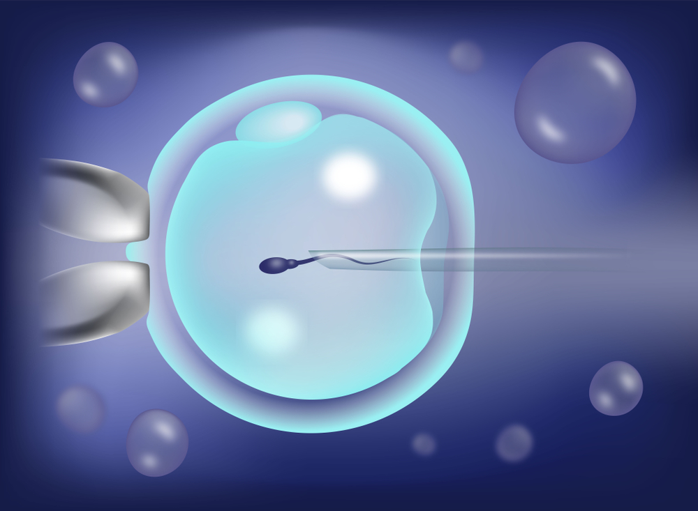 Fertilization In Lab Procedure